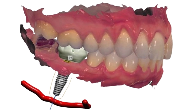 3D моделирование челюсти, изображение Eurodent